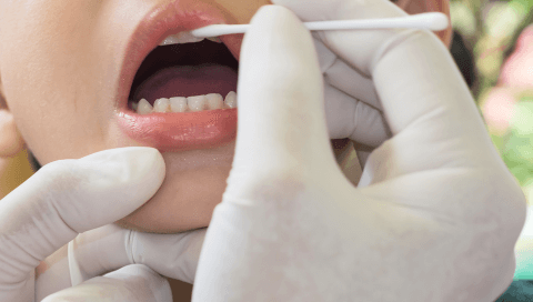 фторирование молочных зубов при кариесе