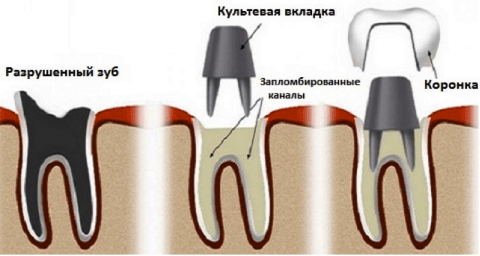 Культевая вкладка фото