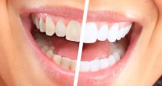 сколько дней заживает десна после удаления зуба для протезирования