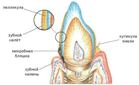Зубной камень
