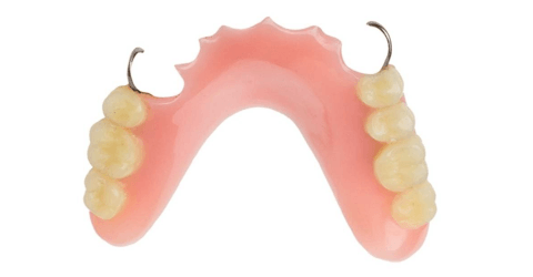 съемный частичный протез при частичном отсутствии зубов