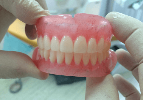 срочный ремонт зубных протезов