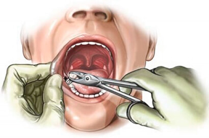 stomatolog-hirurg-3.jpg