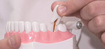 vypadenie-zubov-1.jpg