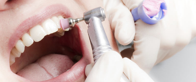 ultrazvukovaya-chistka-zubov2